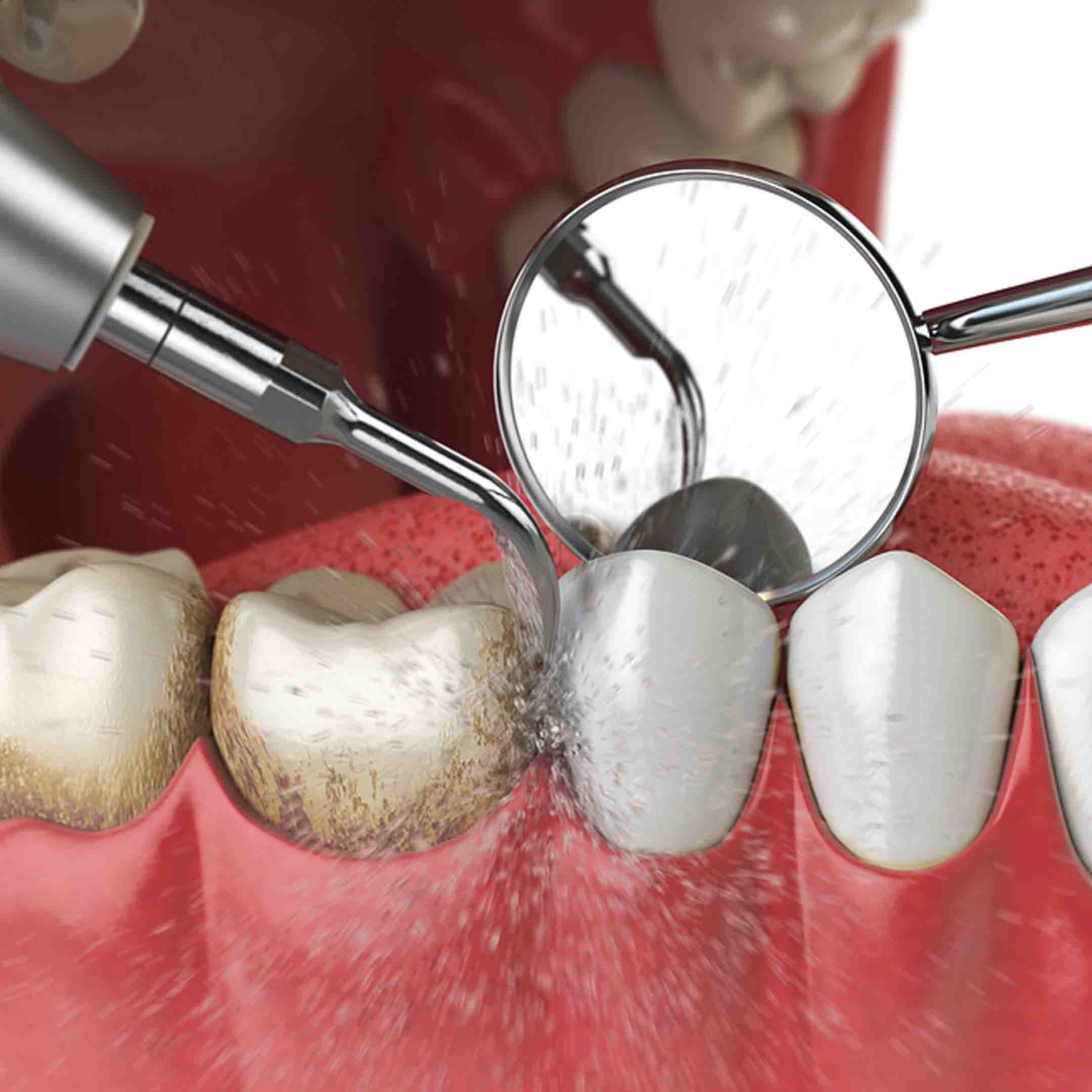 procedure